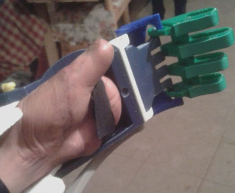 “Un antes y un después”: Fueguino recibió una prótesis gratuita de Atomic Lab