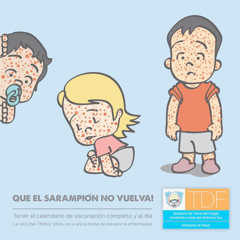 Salud recuerda la importancia de aplicarse la Vacuna Triple Viral