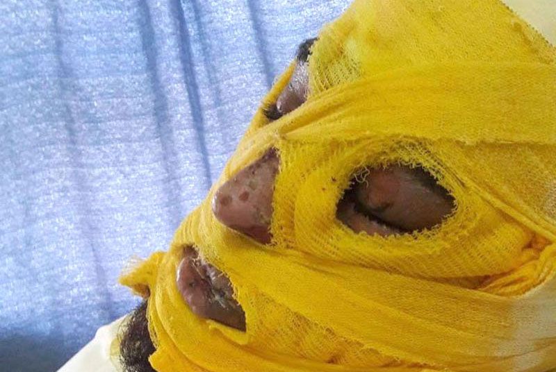 Un recluso de la alcaidía de Ushuaia fue quemado con agua hirviendo por otros presos