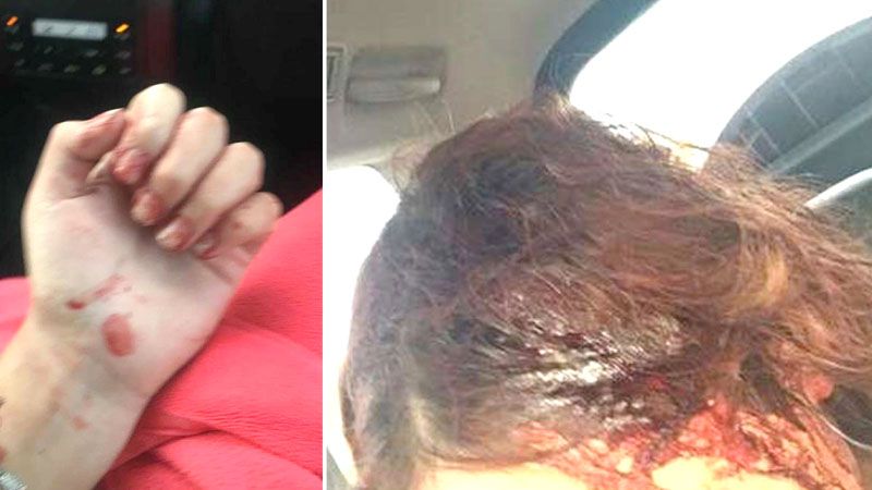 Atacó a dos mujeres e hirió a una en la cabeza con un hacha pero lo procesaron por robo