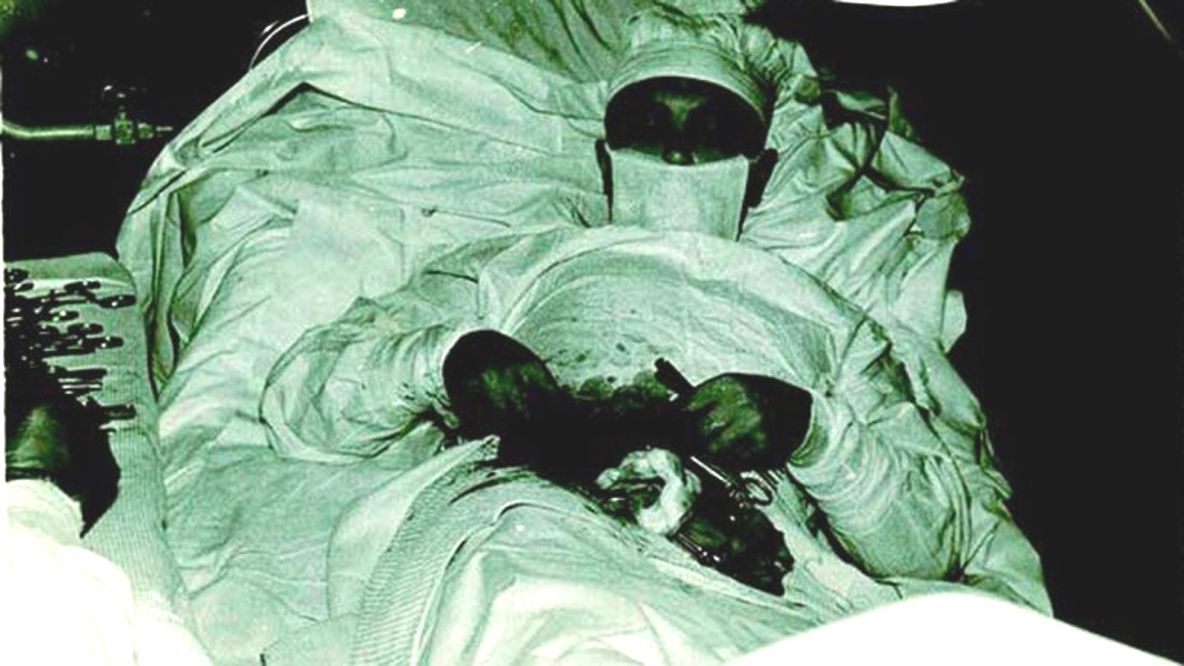 Un cirujano se opera a sí mismo del apéndice en Antártida