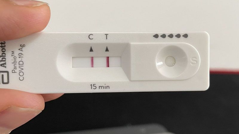 Nación definió el modo en que se deberá informar el resultado de los autotest de covid-19