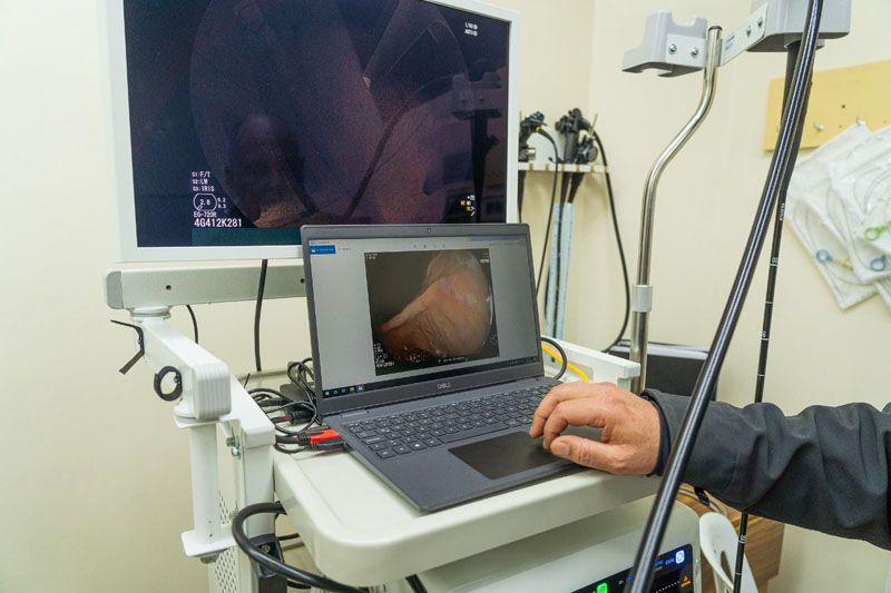 El HRU adquirió un nuevo equipo de videoendoscopia