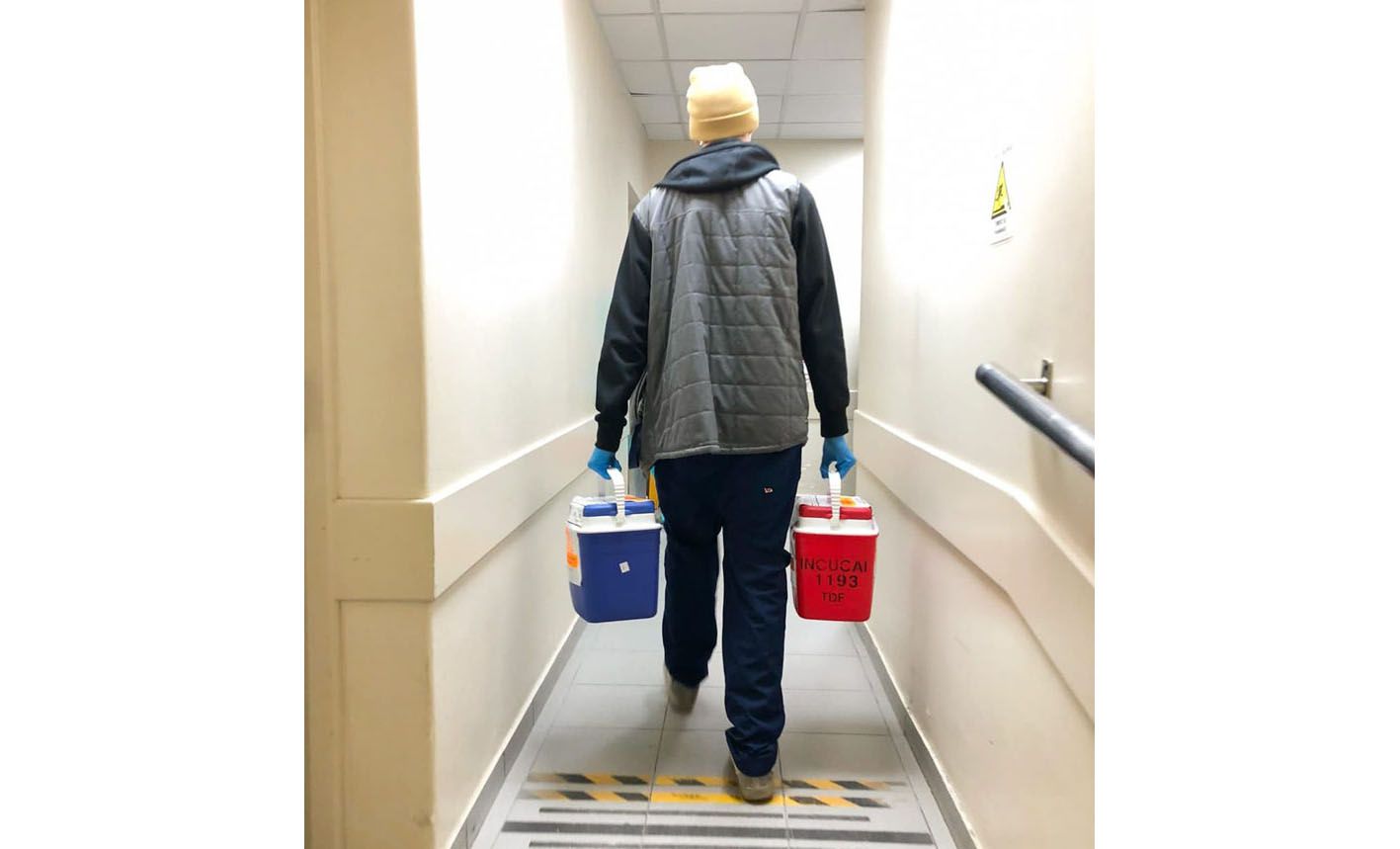 Detallaron la complejidad de la histórica ablación múltiple de órganos