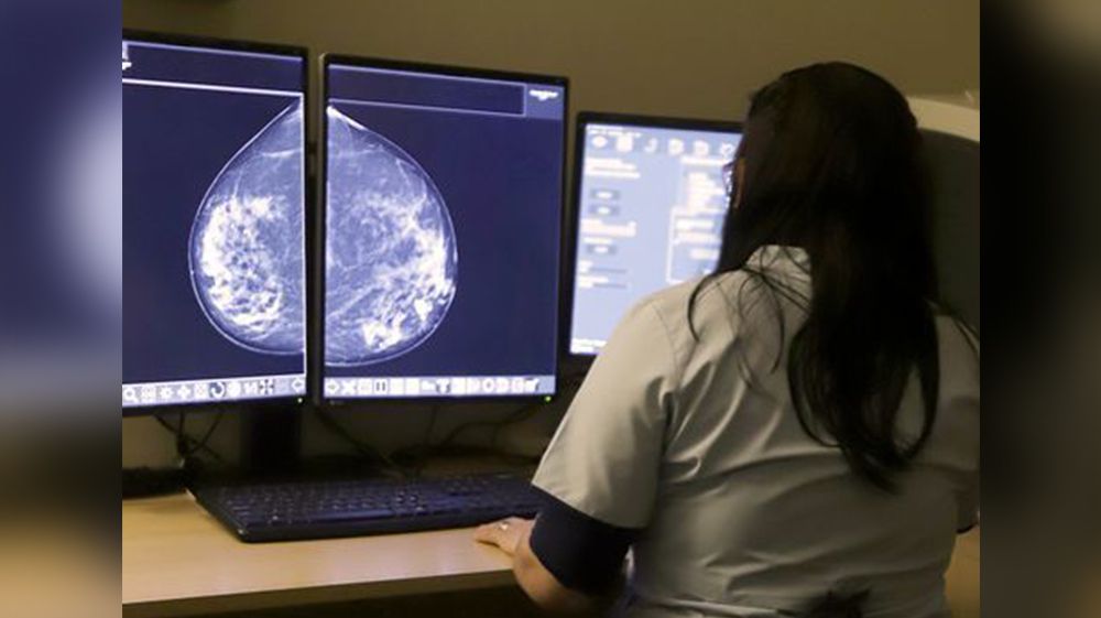 Refuerzan la importancia de la mamografía para prevenir el cáncer de mama