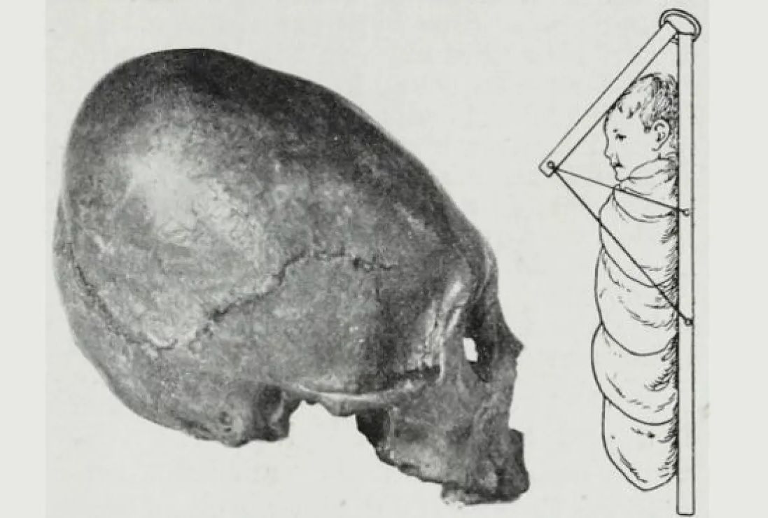 Curiosa costumbre patagona: deformar el cráneo de sus bebés