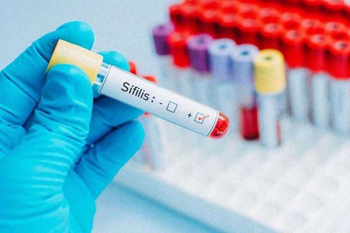 “Los motivos de consulta por sífilis son sumamente frecuentes”