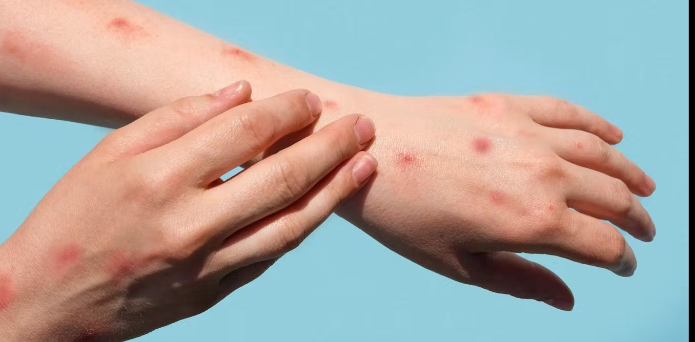 “No hay casos registrados en Tierra del Fuego”