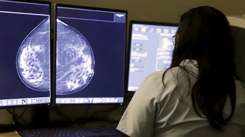 LUCCAU realizará mamografías gratuitas