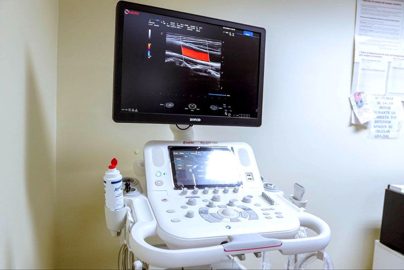 Nuevo ecógrafo para estudios cardiológicos 